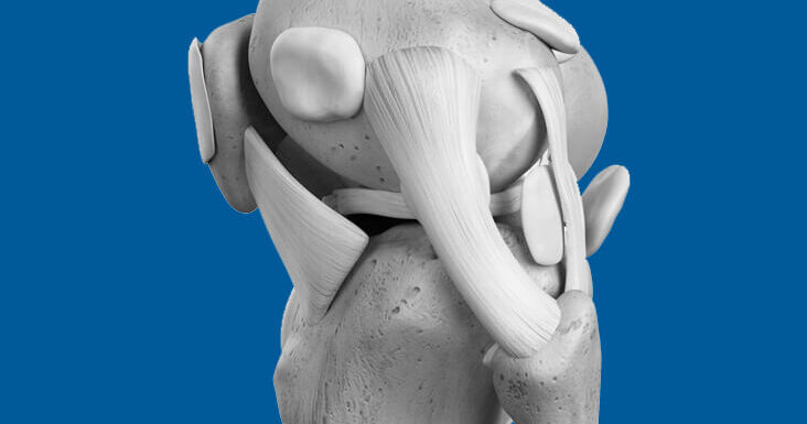 Ligament injuries