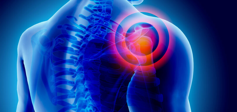 From rotator cuff repair to shoulder replacement