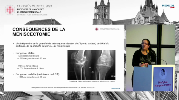 Biomechanics and risk factors