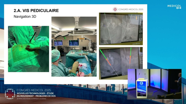 Advances in surgery
