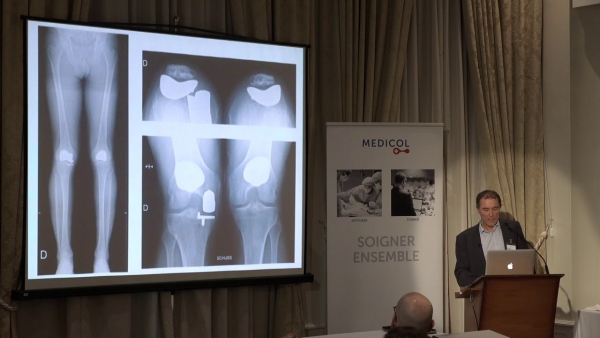 Knee: the patellofemoral