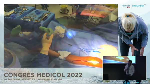 Commentary on surgery: total knee replacement with the ROSA robot