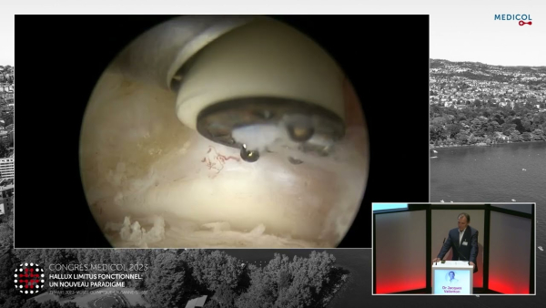 Surgeries with commentary