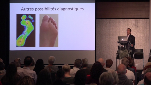 Functional hallux limitus (HLF): the role of HLF in gait and posture disorders