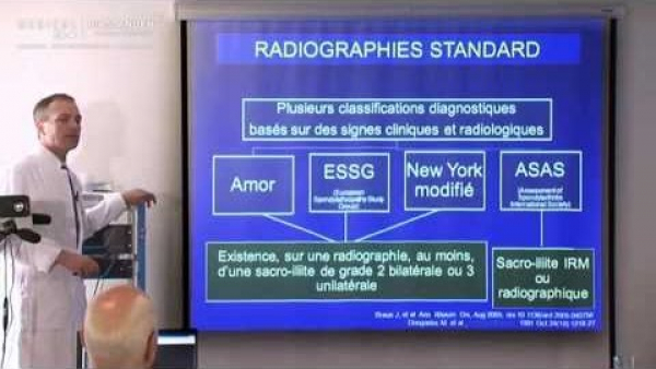 Imaging of sacroiliac joints in SPA