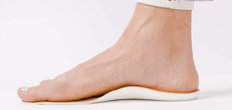 Decompensated flat feet in adults